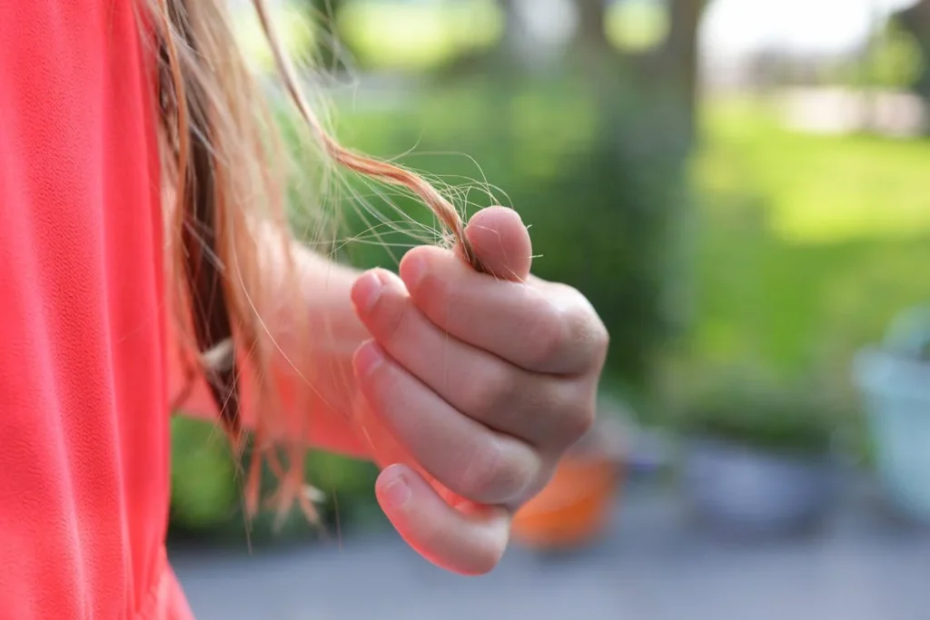 Does creatine cause hair loss